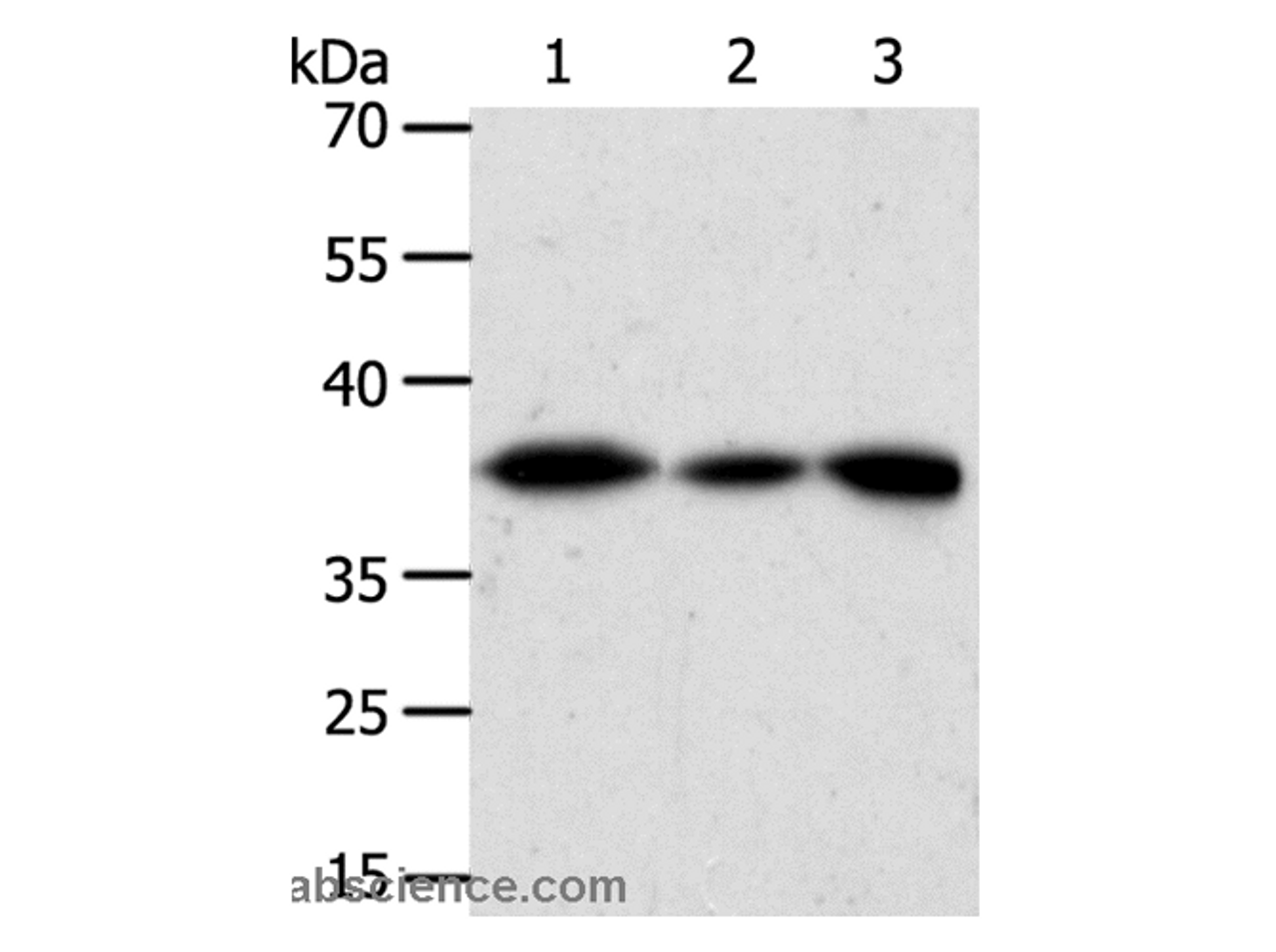 Western Blot analysis of Human liver cancer tissue, hela cell and Human fetal kidney tissue using AKR1A1 Polyclonal Antibody at dilution of 1:450