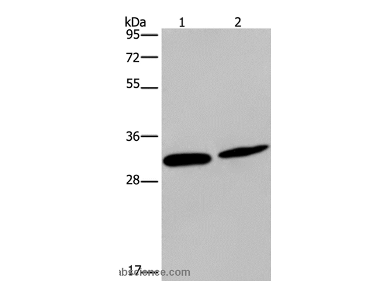 Western Blot analysis of Mouse skin tissue and Hela cell using GJB4 Polyclonal Antibody at dilution of 1:200