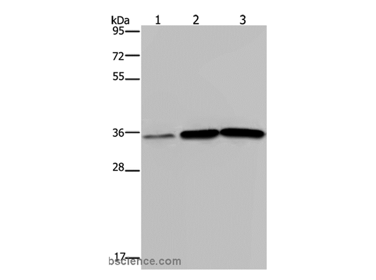 Western Blot analysis of Human testis tissue, A549 and PC3 cell using MAGEA3 Polyclonal Antibody at dilution of 1:400