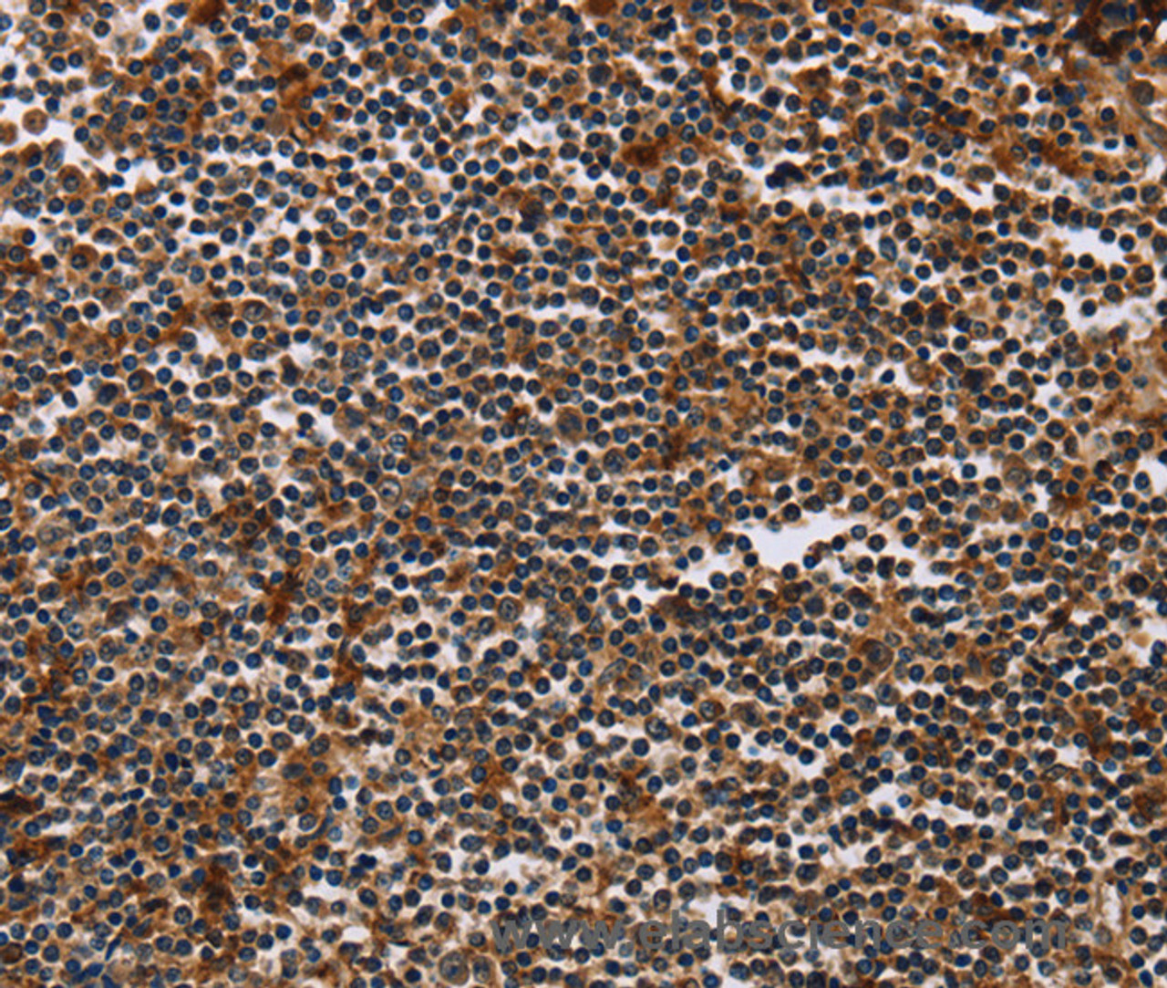 Immunohistochemistry of paraffin-embedded Human tonsil using MAGEA3 Polyclonal Antibody at dilution of 1:50