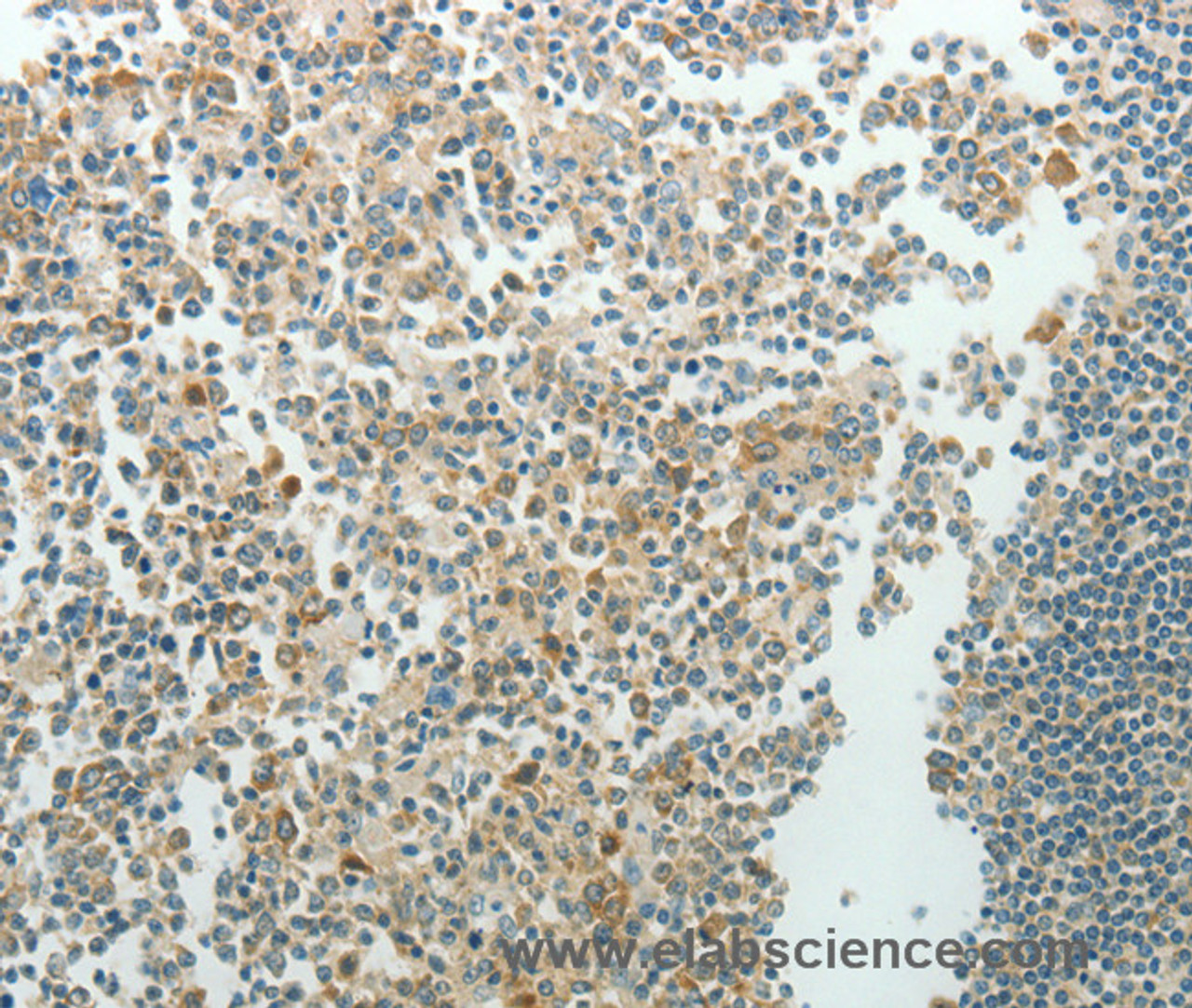 Immunohistochemistry of paraffin-embedded Human tonsil using NDRG3 Polyclonal Antibody at dilution of 1:70