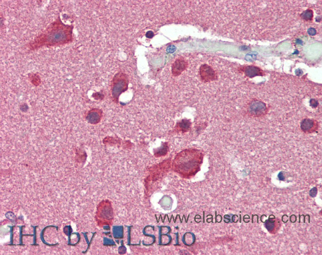 Immunohistochemistry of paraffin-embedded Brain, Cortex tissue using SLC8A3 Polyclonal Antibody at dilution of 1:50(Elabscience® Product Detected by Lifespan).