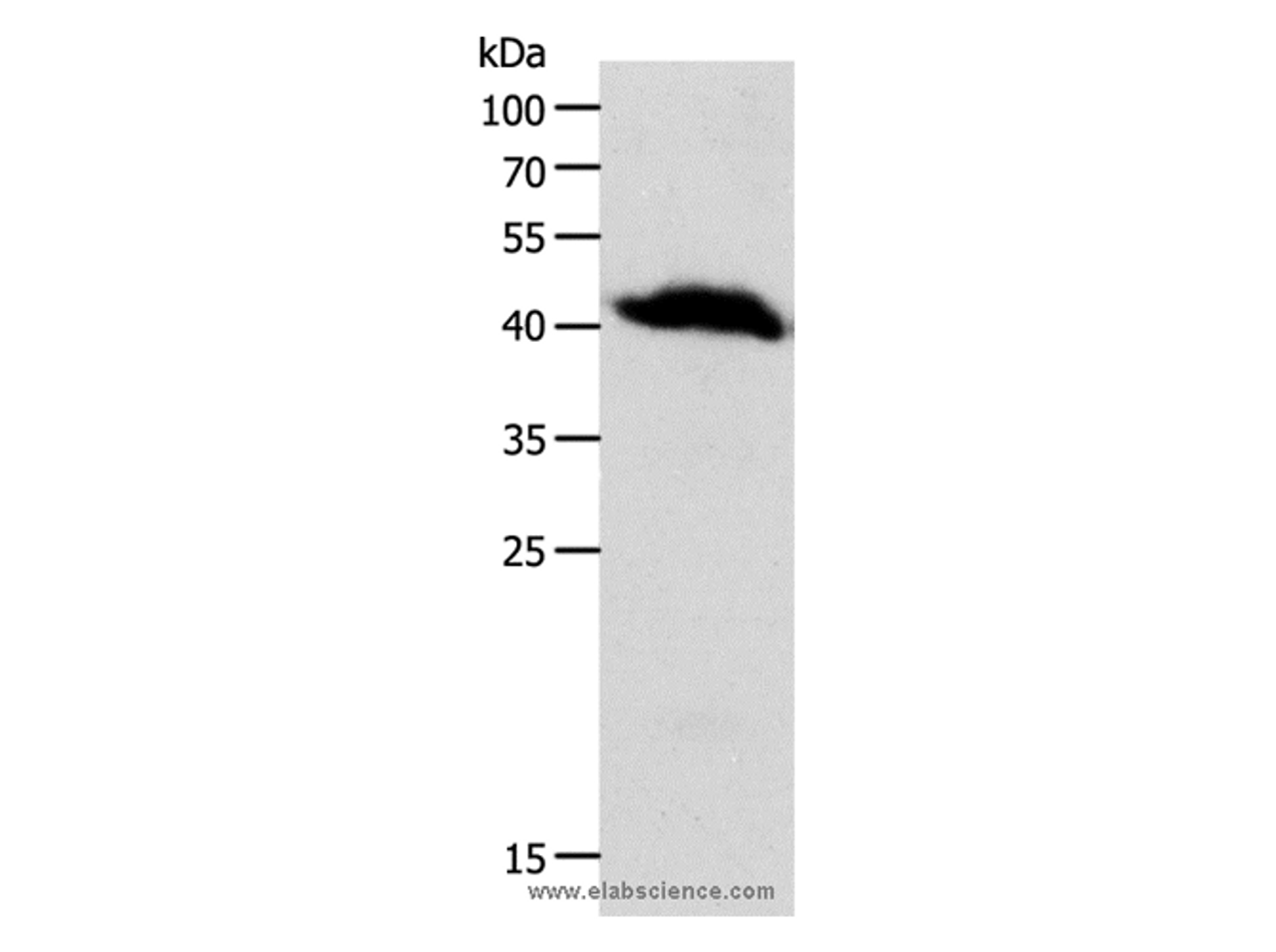 Western Blot analysis of Human liver cancer tissue using OPRL1 Polyclonal Antibody at dilution of 1:900
