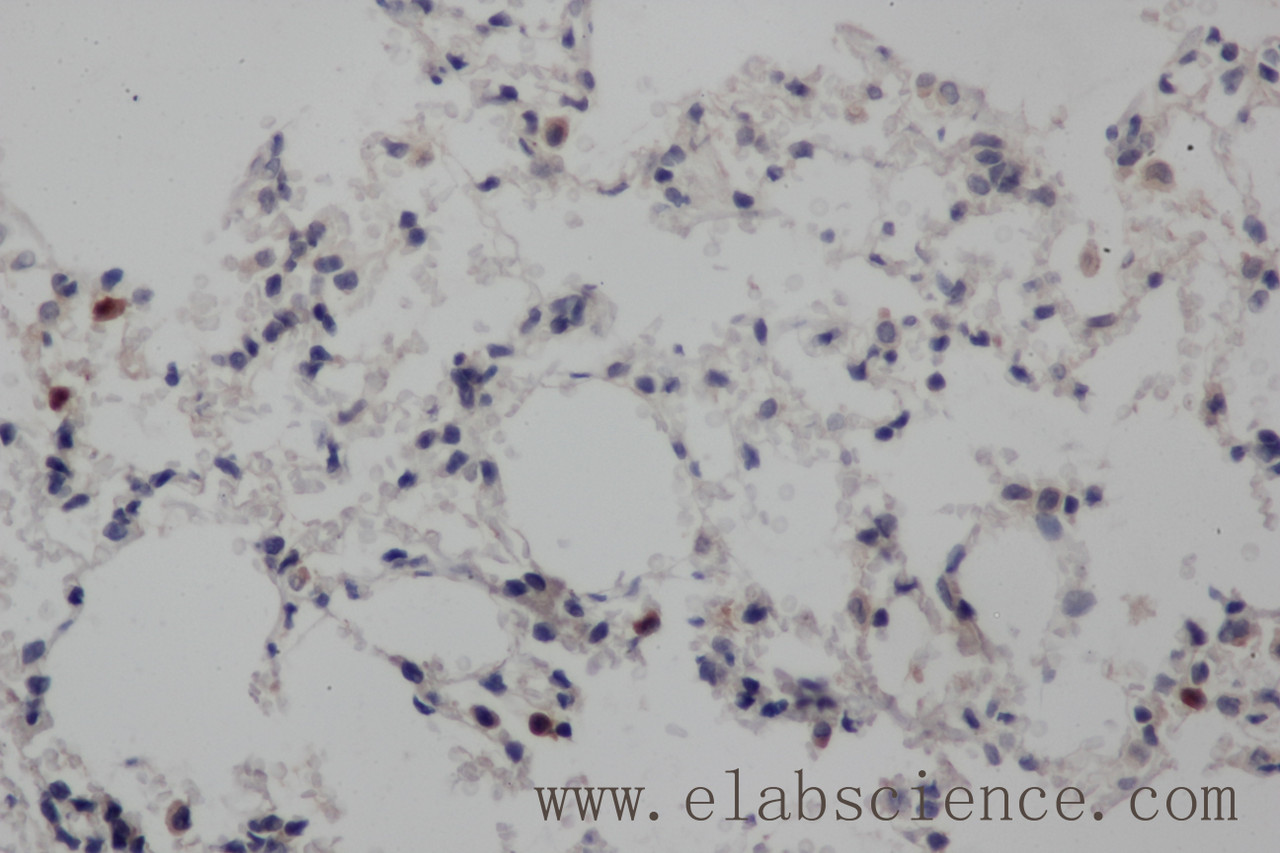 Immunohistochemistry of paraffin-embedded Rat lung using NOTCH1 Polyclonal Antibody at dilution of 1:50