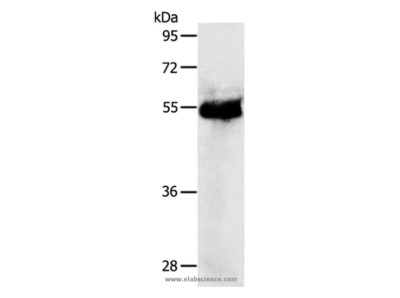 Western Blot analysis of Human colon cancer tissue using PRKAR1B Polyclonal Antibody at dilution of 1:1200