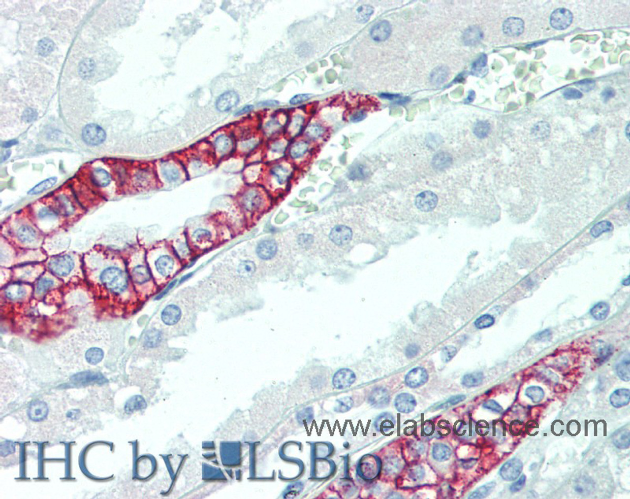 Immunohistochemistry of paraffin-embedded Kidney tissue using SCN10A Polyclonal Antibody at dilution of 1:100(Elabscience® Product Detected by Lifespan).