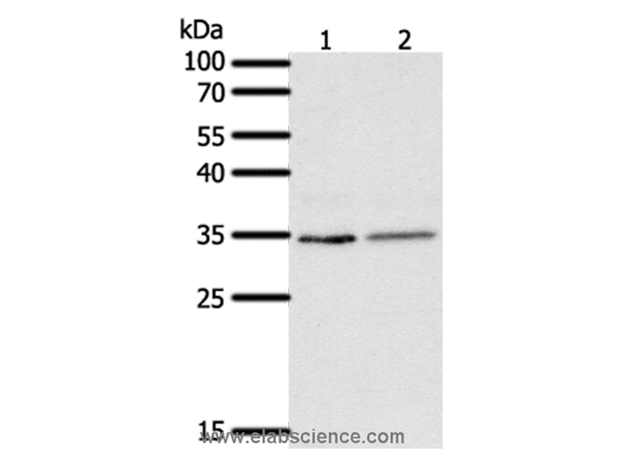 Western Blot analysis of Human fetal lung tissue and A549 cell using SFTPA1 Polyclonal Antibody at dilution of 1:300