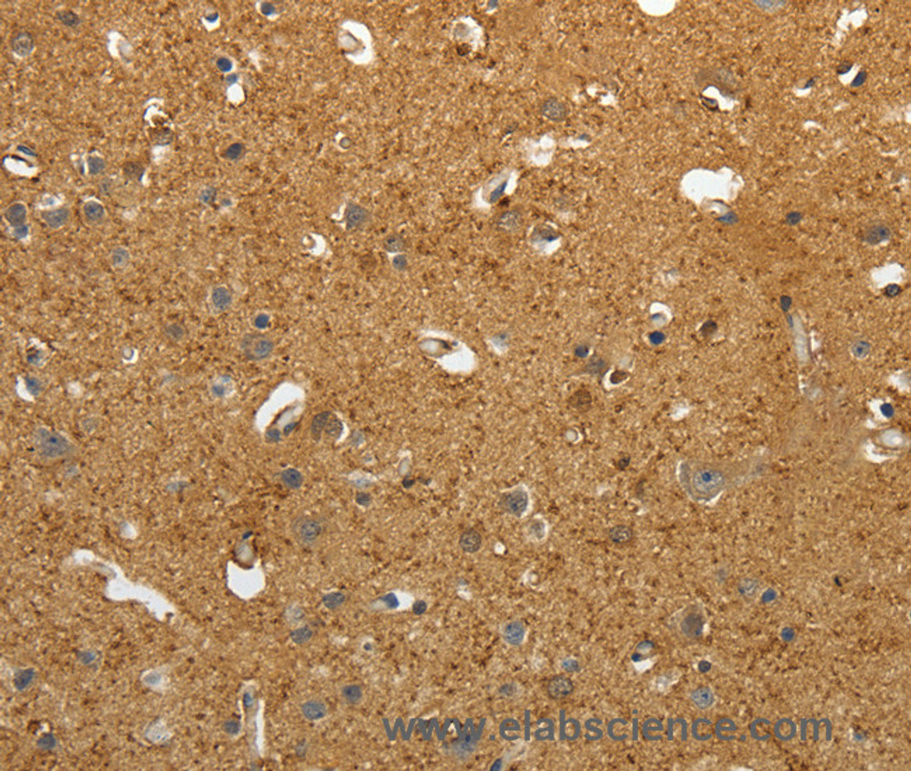 Immunohistochemistry of paraffin-embedded Human brain tissue using AKAP12 Polyclonal Antibody at dilution 1:40