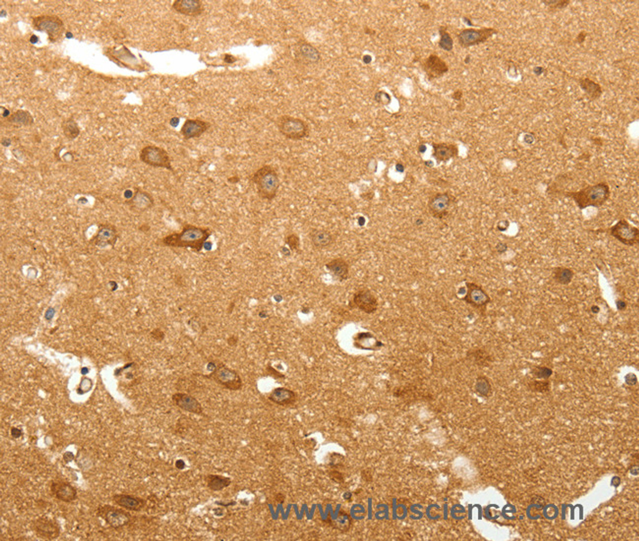 Immunohistochemistry of paraffin-embedded Human brain tissue using MAP1B  Polyclonal Antibody at dilution 1:60