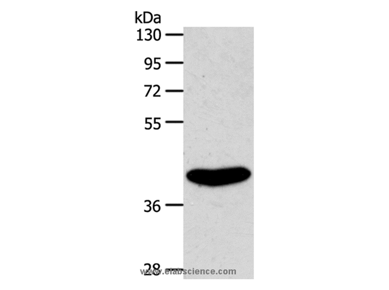 Western Blot analysis of Rat kidney tissue using EDG6 Polyclonal Antibody at dilution of 1:800