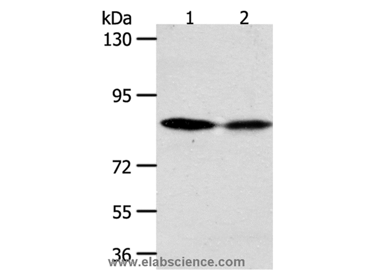 Western Blot analysis of Hela and SKOV3 cell using ADAM11 Polyclonal Antibody at dilution of 1:500