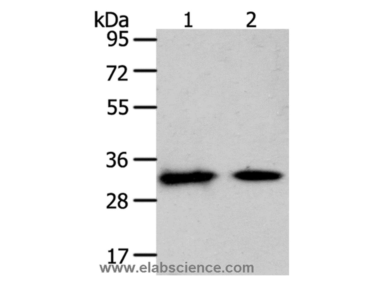 Western Blot analysis of Mouse heart and muscle tissue using SLC25A4 Polyclonal Antibody at dilution of 1:400