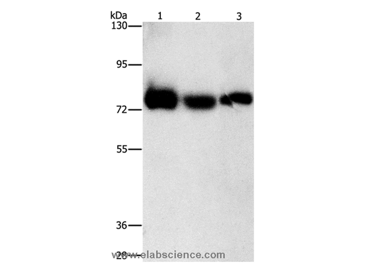 Western Blot analysis of Human fetal muscle tissue, K562 and hela cell using AMPD1 Polyclonal Antibody at dilution of 1:1600