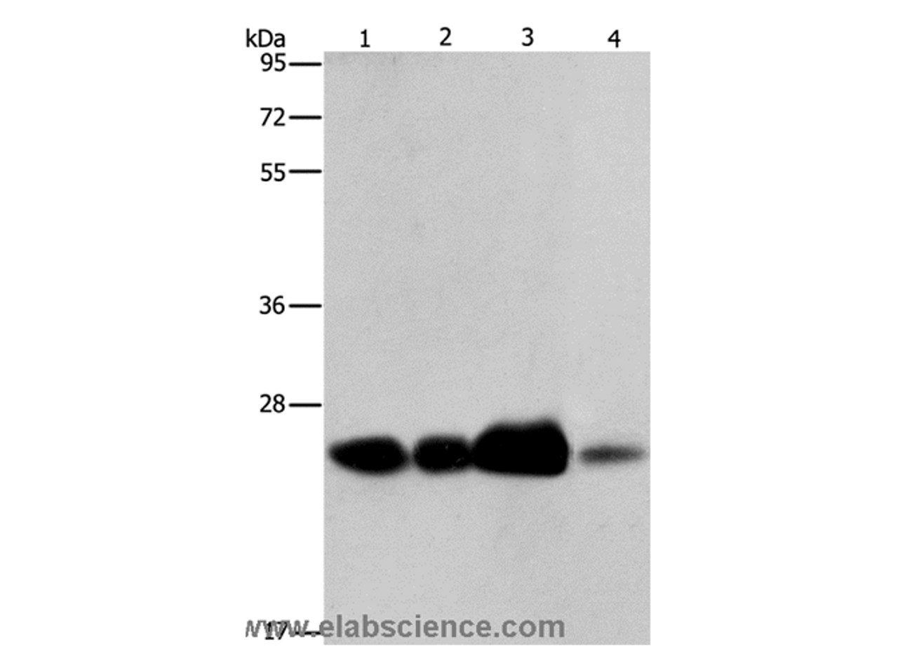 Western Blot analysis of 293T cell and Human fetal liver tissue, Human cervical cancer and fetal muscle tissue using ARFRP1 Polyclonal Antibody at dilution of 1:800
