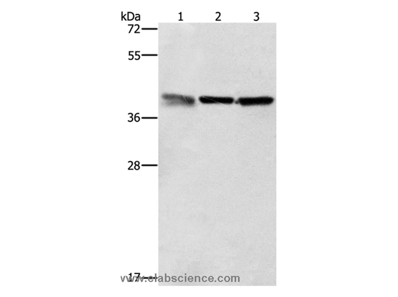 Western Blot analysis of A549, K562 and PC3 cell using ZFP42 Polyclonal Antibody at dilution of 1:500
