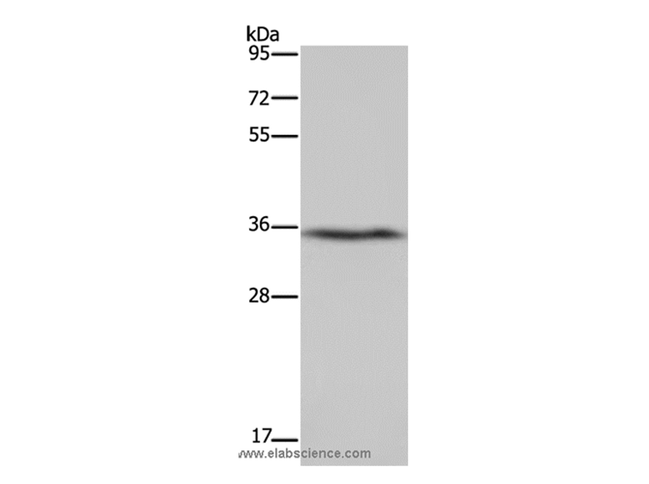 Western Blot analysis of Human fetal liver tissue using DDAH1 Polyclonal Antibody at dilution of 1:400