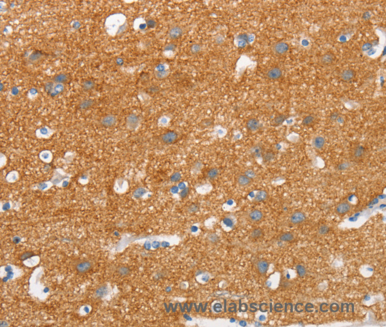Immunohistochemistry of paraffin-embedded Human brain tissue using SNCA Polyclonal Antibody at dilution 1:30