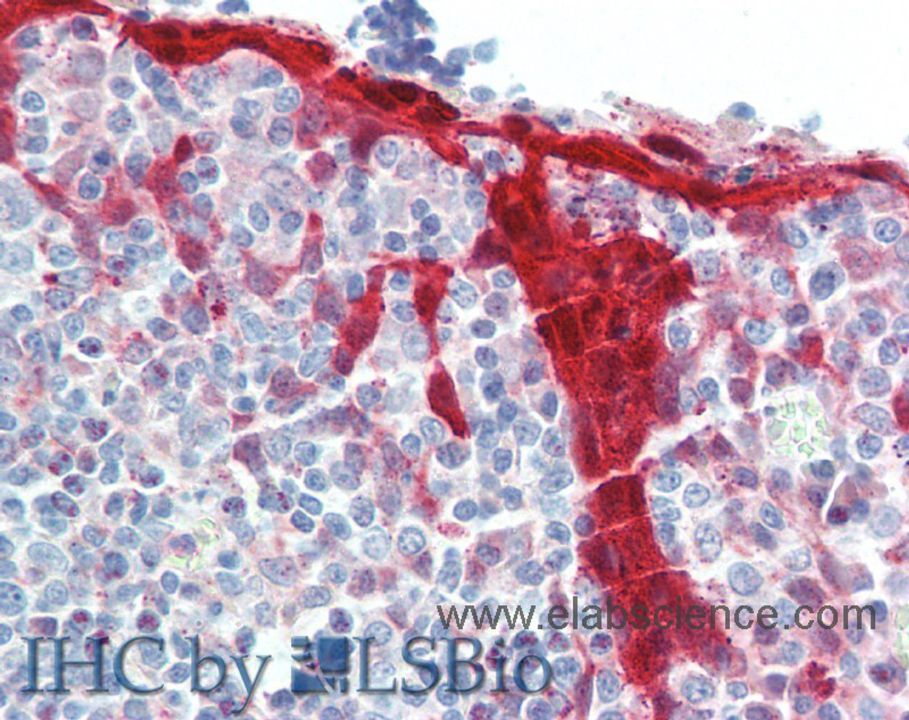 Immunohistochemistry of paraffin-embedded Tonsil tissue using NLRP7 Polyclonal Antibody at dilution of 1:100(Elabscience® Product Detected by Lifespan).
