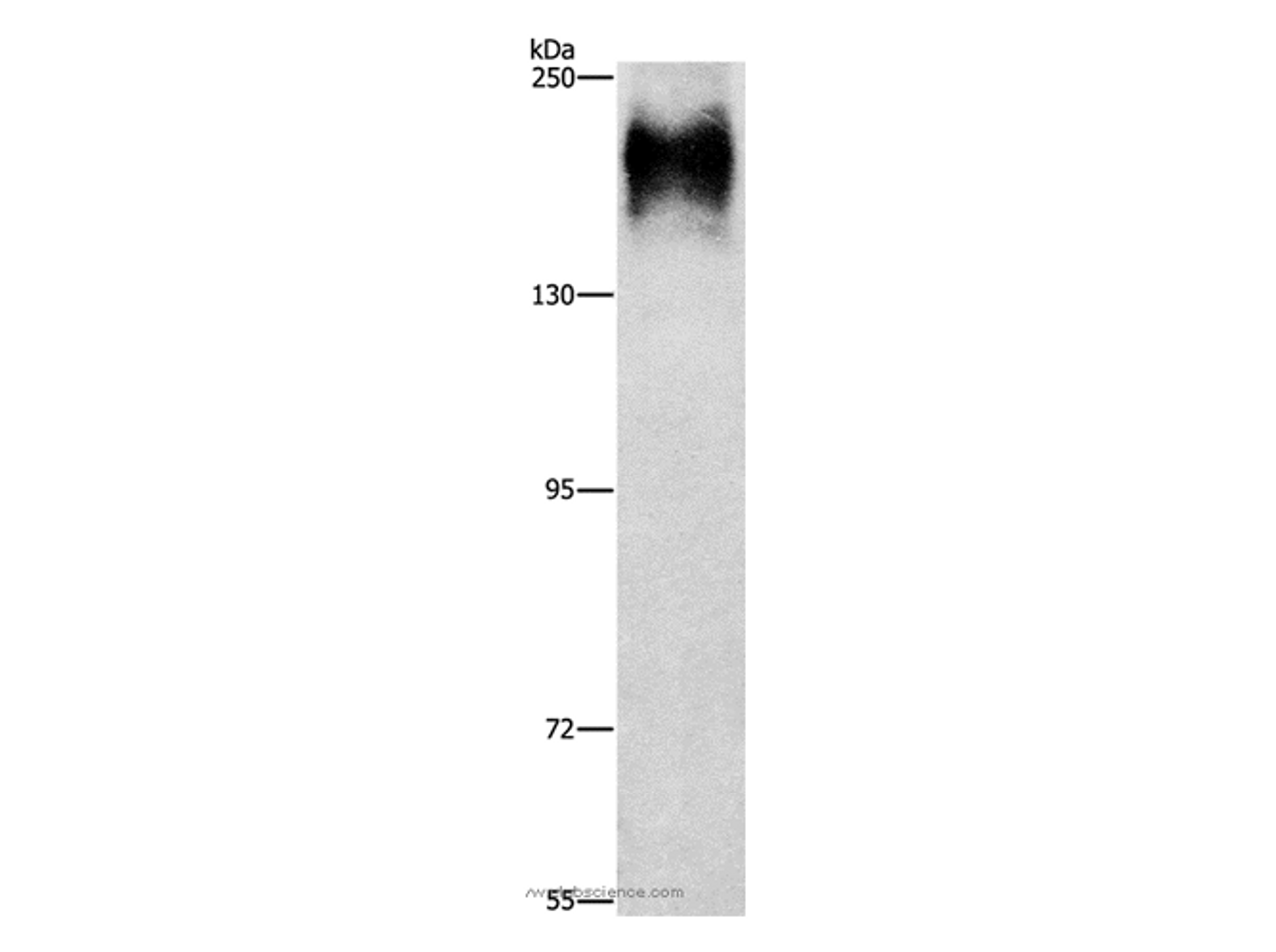 Western Blot analysis of HepG2 cell using ATP7A  Polyclonal Antibody at dilution of 1:800