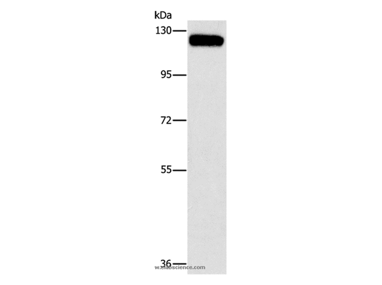 Western Blot analysis of 231 cell using CBL Polyclonal Antibody at dilution of 1:750