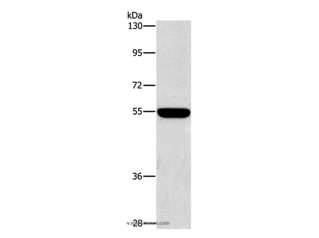 Western Blot analysis of A549 cell using CD328 Polyclonal Antibody at dilution of 1:650