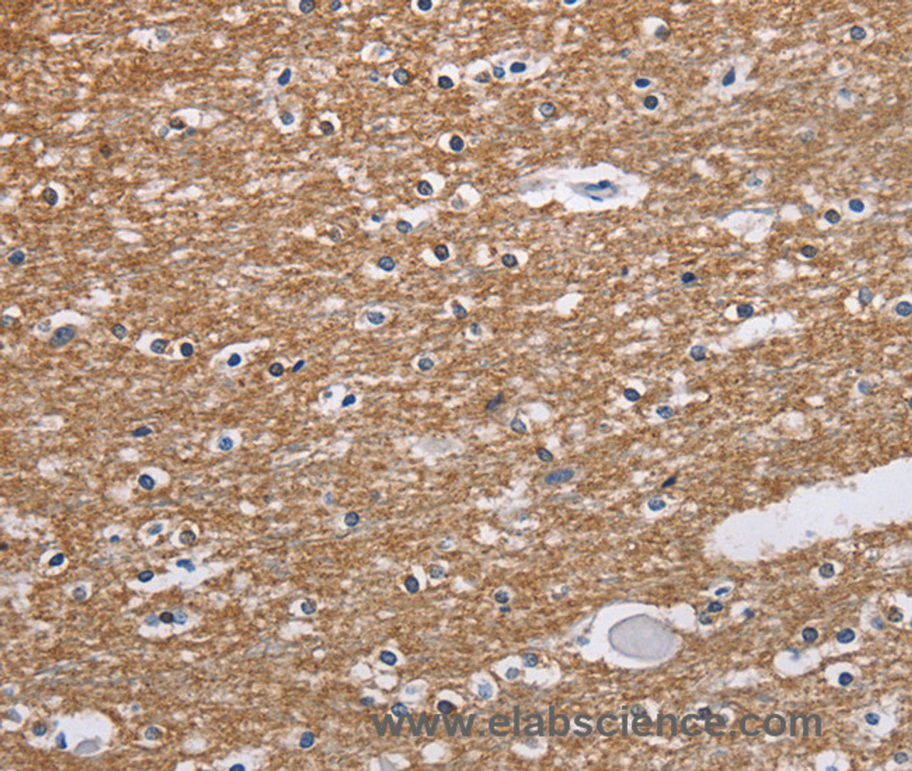 Immunohistochemistry of paraffin-embedded Human brain  tissue using NCR2 Polyclonal Antibody at dilution 1:60