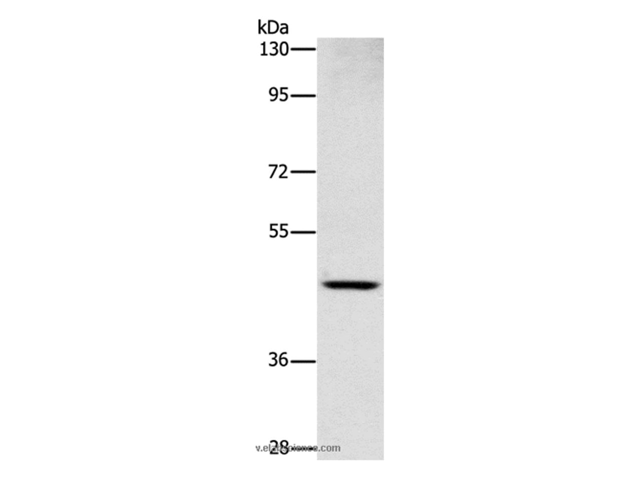 Western Blot analysis of Human placenta tissue using CD327 Polyclonal Antibody at dilution of 1:1000
