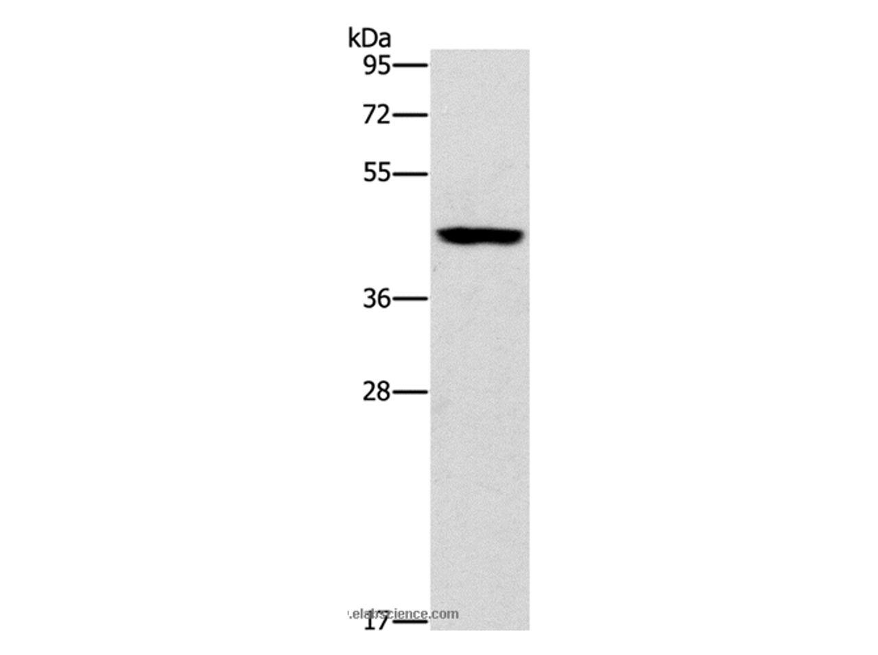 Western Blot analysis of Mouse brain tissue using B3GAT1 Polyclonal Antibody at dilution of 1:400