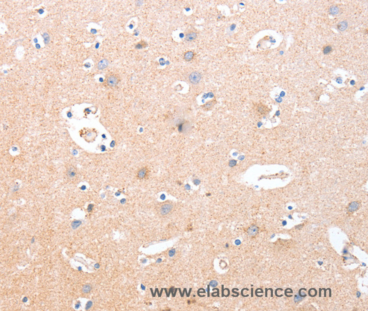 Immunohistochemistry of paraffin-embedded Human brain  using B3GAT1 Polyclonal Antibody at dilution of 1:40