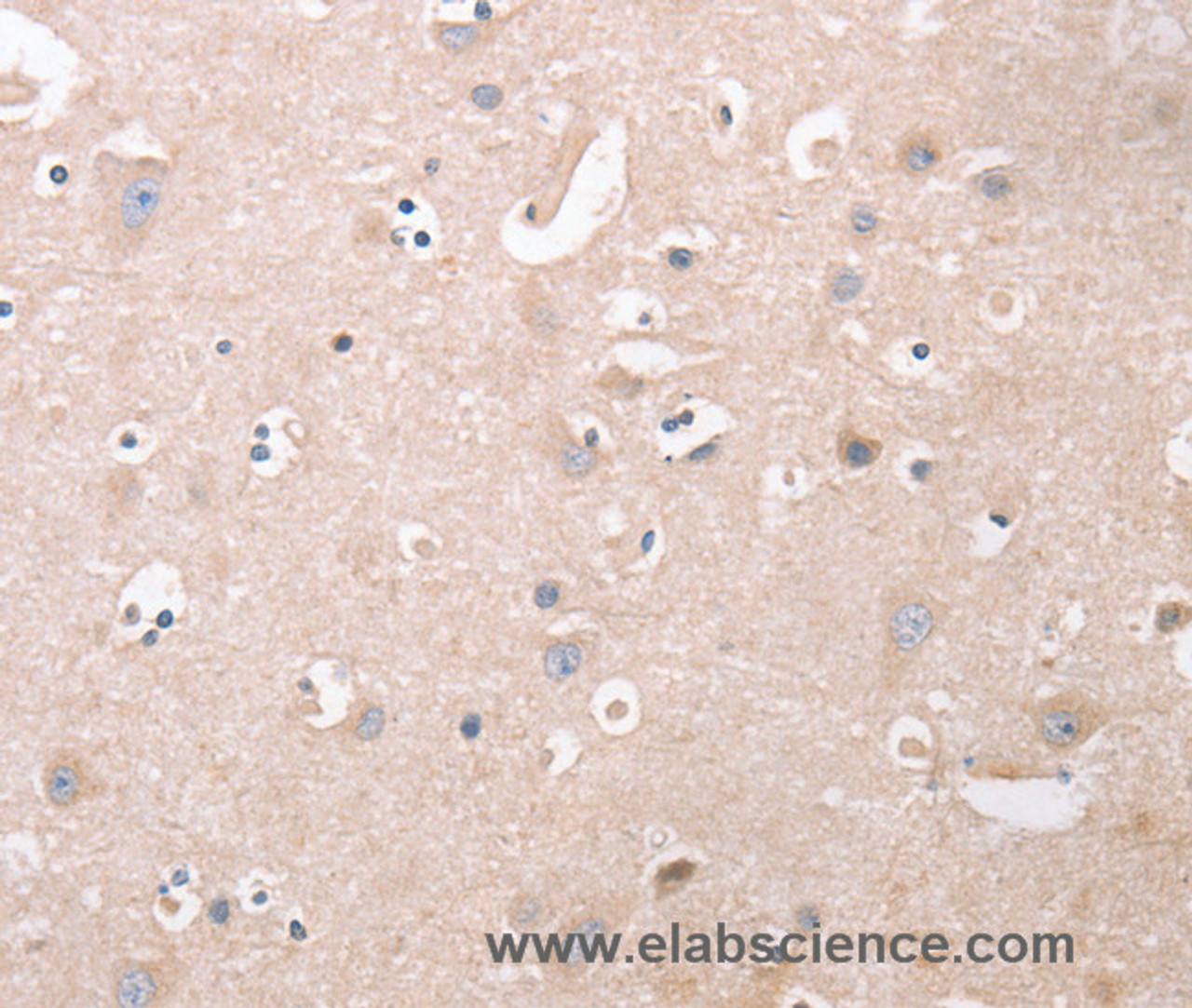 Immunohistochemistry of paraffin-embedded Human brain  tissue using CDCA4 Polyclonal Antibody at dilution 1:50