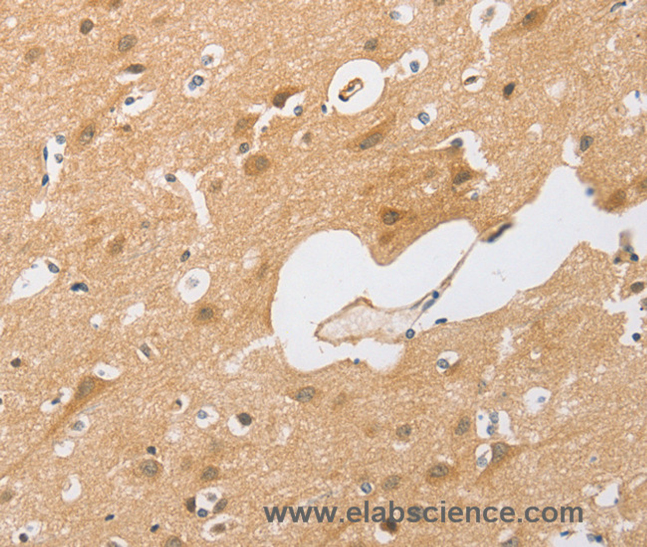 Immunohistochemistry of paraffin-embedded Human brain tissue using CEBP beta Polyclonal Antibody at dilution 1:60