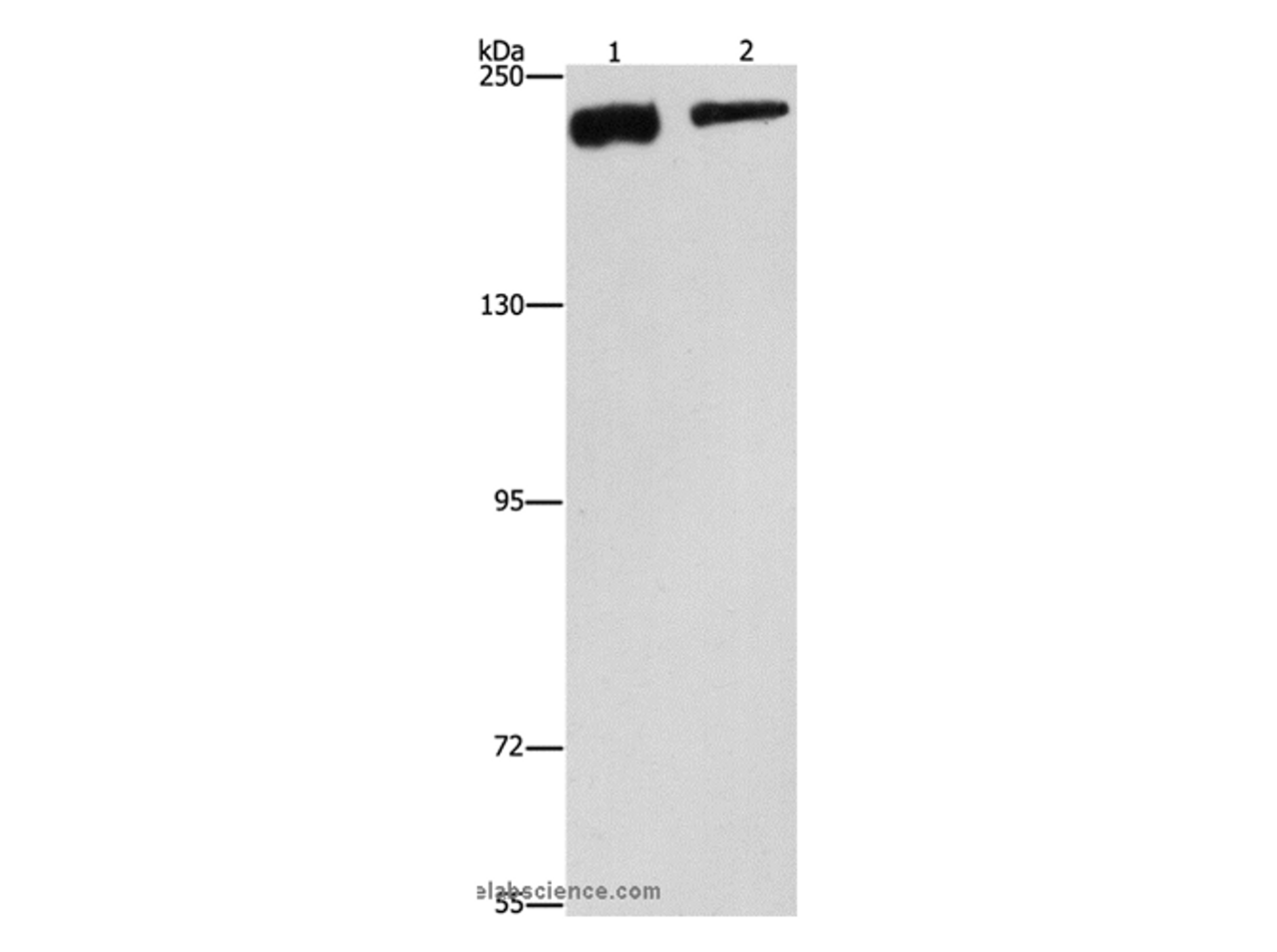 Western Blot analysis of NIH/3T3 and hela cell using CLTC Polyclonal Antibody at dilution of 1:300