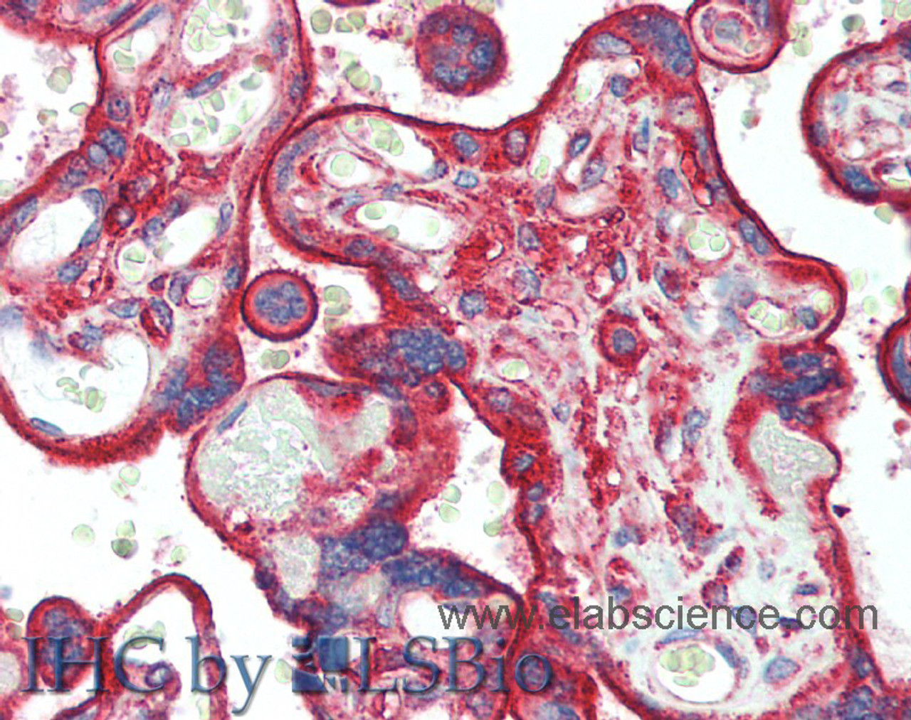 Immunohistochemistry of paraffin-embedded Placenta tissue using CLTC Polyclonal Antibody at dilution of 1:60(Elabscience® Product Detected by Lifespan).
