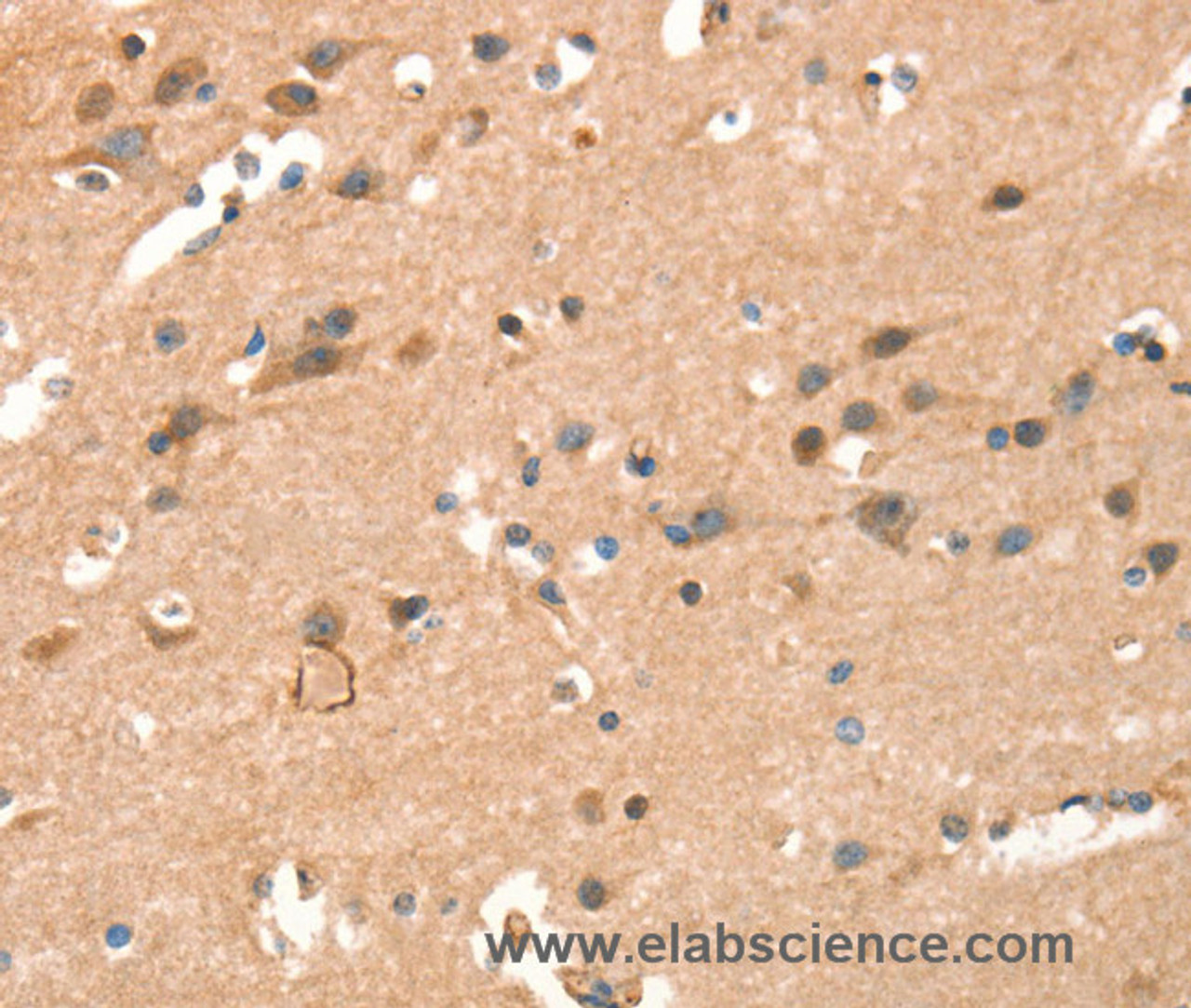 Immunohistochemistry of paraffin-embedded Human brain  using CRELD1 Polyclonal Antibody at dilution of 1:40