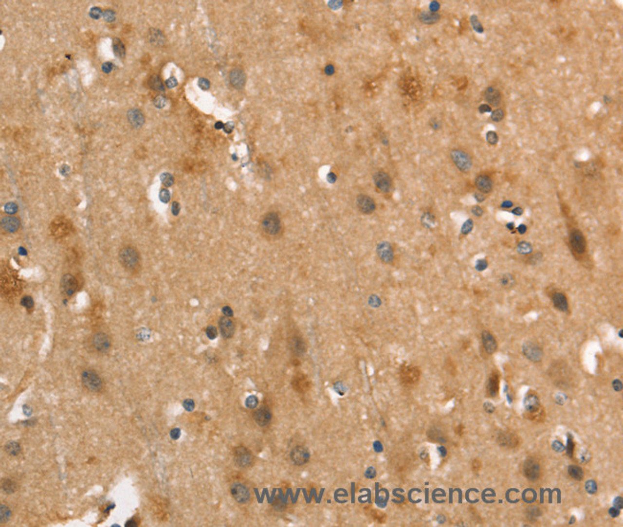 Immunohistochemistry of paraffin-embedded Human brain  using CALCRL Polyclonal Antibody at dilution of 1:40