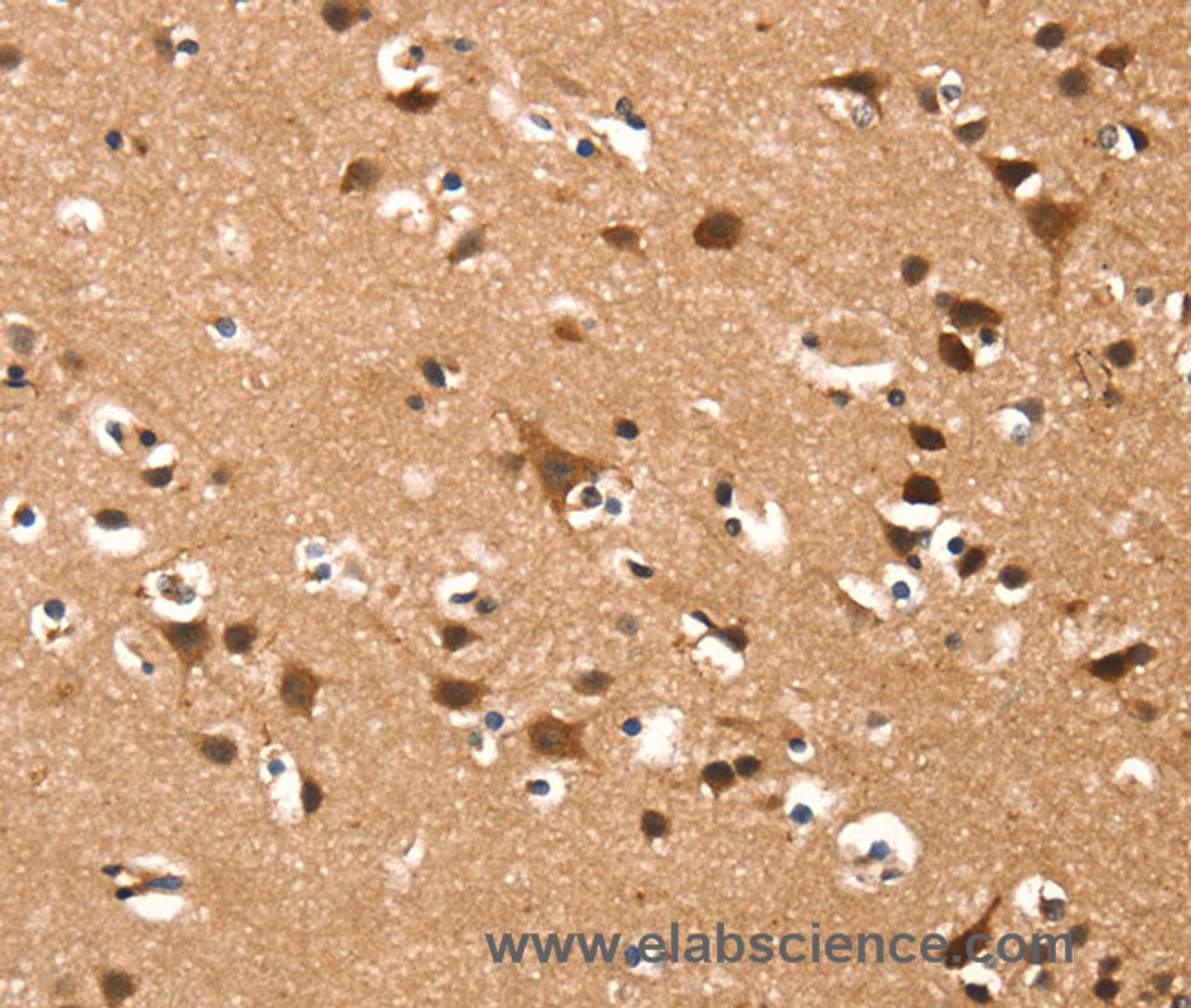 Immunohistochemistry of paraffin-embedded Human brain  using DAAM1 Polyclonal Antibody at dilution of 1:50