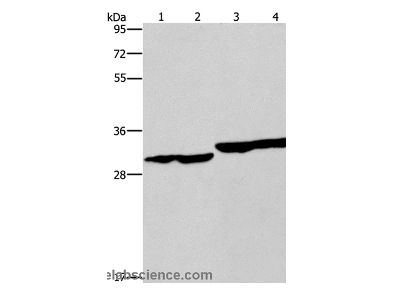 Western Blot analysis of Human endometrial carcinoma and colon cancer tissue, Human fetal liver tissue and PC3 cell using DECR1 Polyclonal Antibody at dilution of 1:300