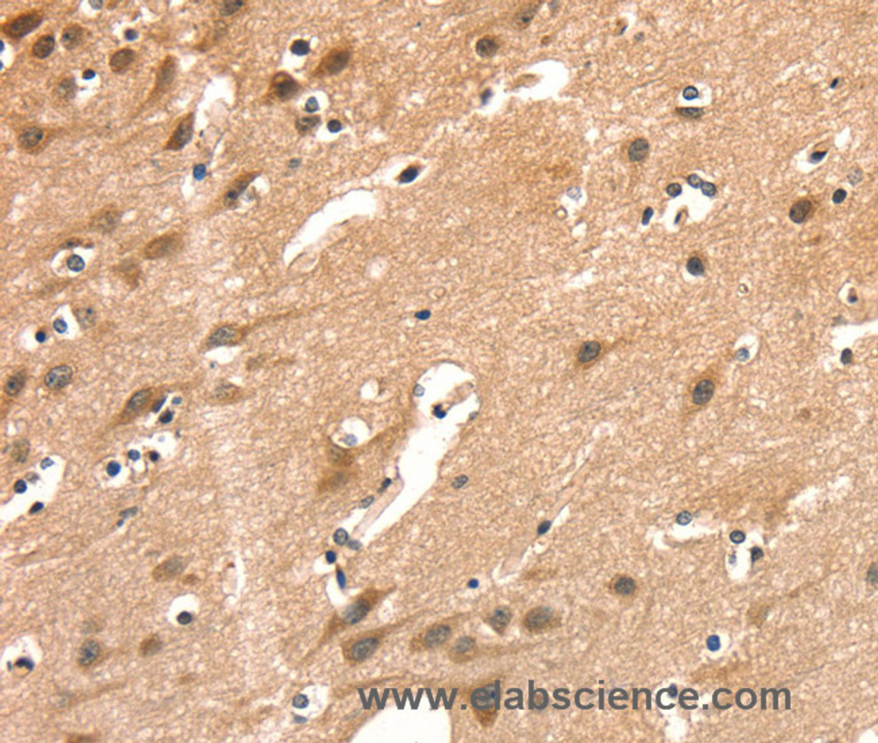 Immunohistochemistry of paraffin-embedded Human brain  using AIMP1 Polyclonal Antibody at dilution of 1:40