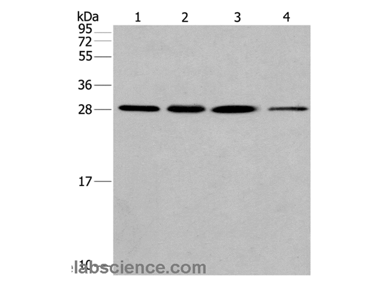 Western Blot analysis of Hela cell and Human fetal liver tissue, A549 and 293T cell using ERP29 Polyclonal Antibody at dilution of 1:200