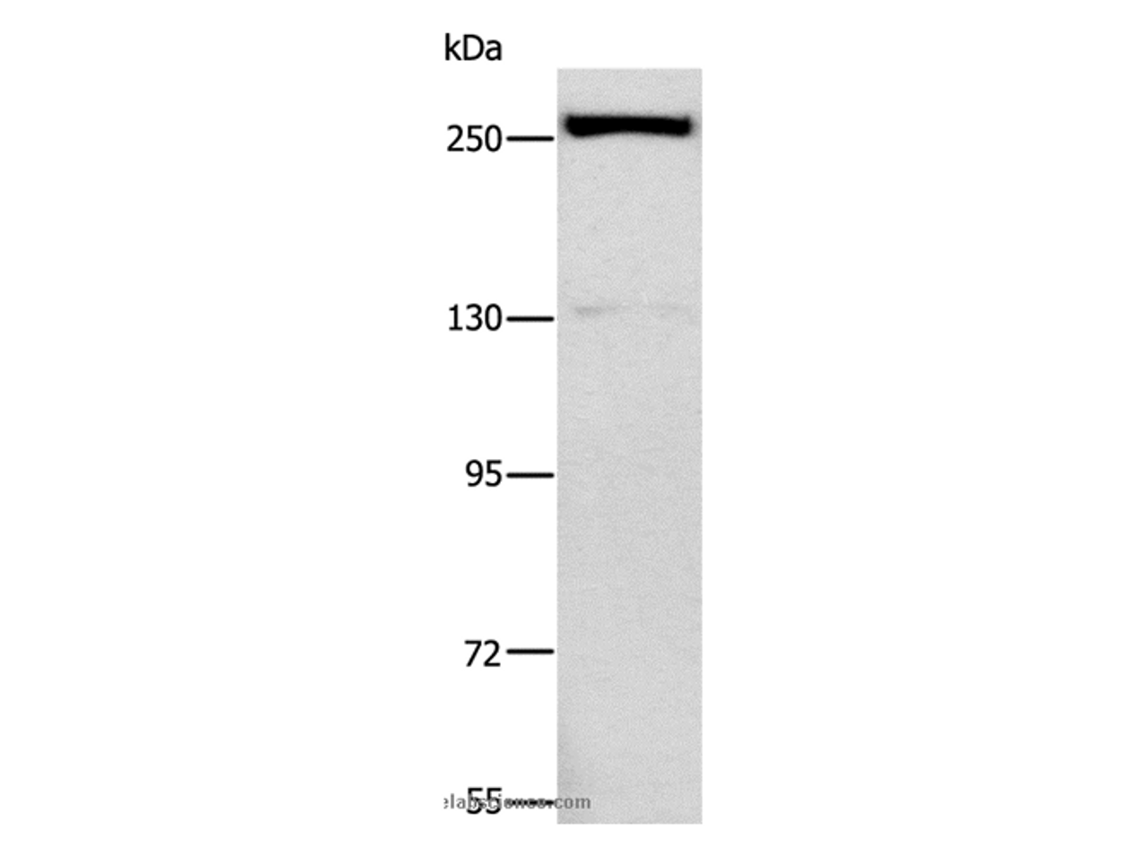 Western Blot analysis of Raji cell using ESPL1 Polyclonal Antibody at dilution of 1:500