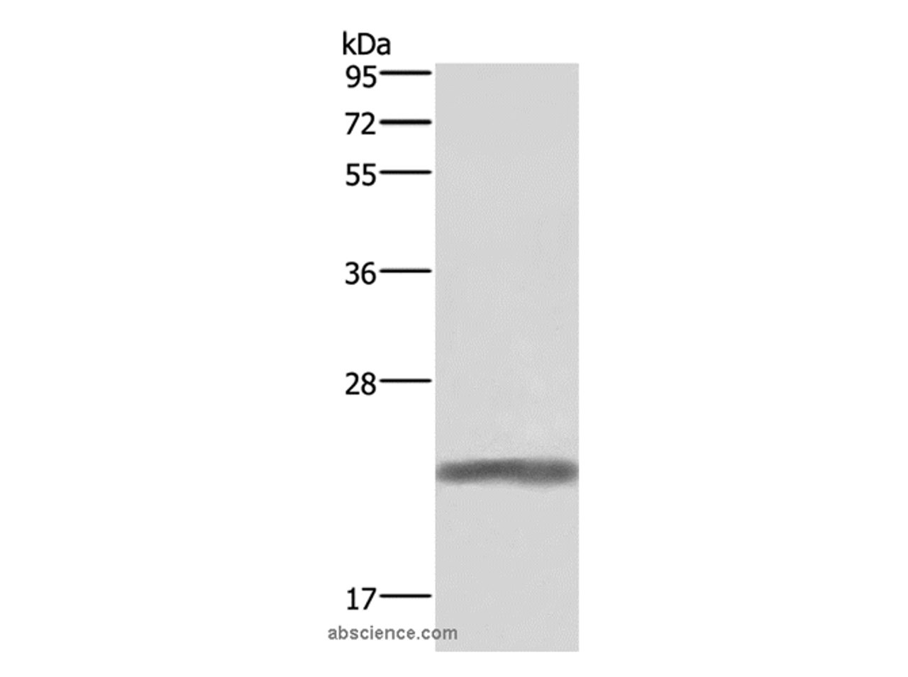 Western Blot analysis of Human placenta tissue   using GH1 Polyclonal Antibody at dilution of 1:500