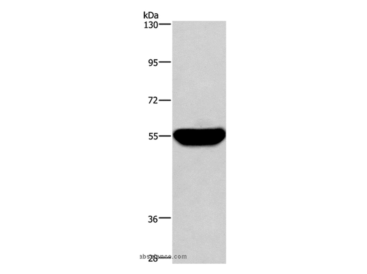 Western Blot analysis of Human fetal liver tissue using HMGCS1 Polyclonal Antibody at dilution of 1:300