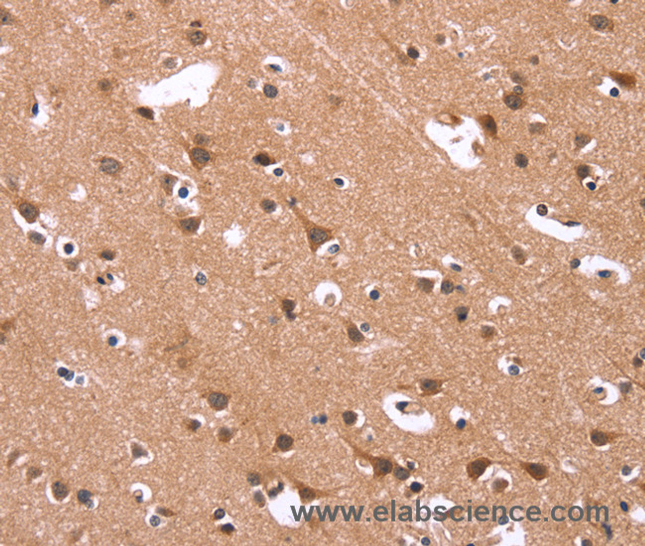 Immunohistochemistry of paraffin-embedded Human brain  using HSD17B1 Polyclonal Antibody at dilution of 1:40