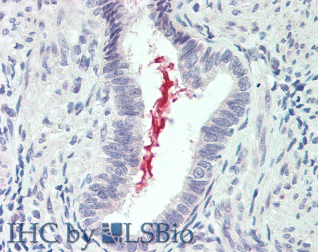 Immunohistochemistry of paraffin-embedded Lung tissue using IL19 Polyclonal Antibody at dilution of 1:90 (Elabscience® Product Detected by Lifespan).