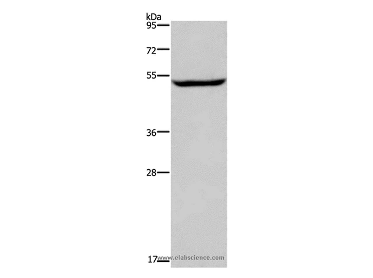 Western Blot analysis of Raji cell using IMPDH1 Polyclonal Antibody at dilution of 1:450