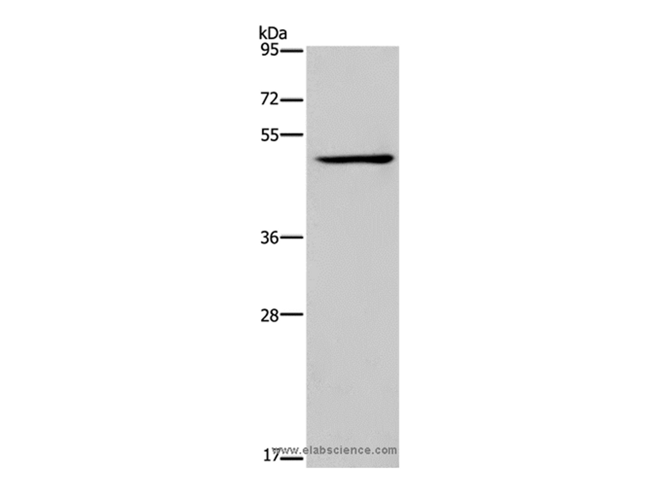 Western Blot analysis of Jurkat cell using IRF4 Polyclonal Antibody at dilution of 1:400