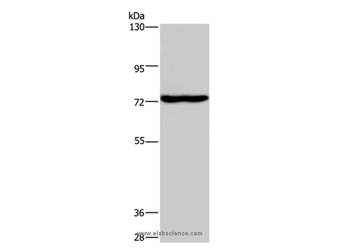 Western Blot analysis of Mouse brain tissue using KCND1 Polyclonal Antibody at dilution of 1:400