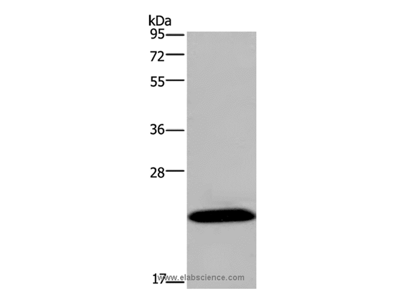 Western Blot analysis of Mouse brain tissue using KCNMB4 Polyclonal Antibody at dilution of 1:500