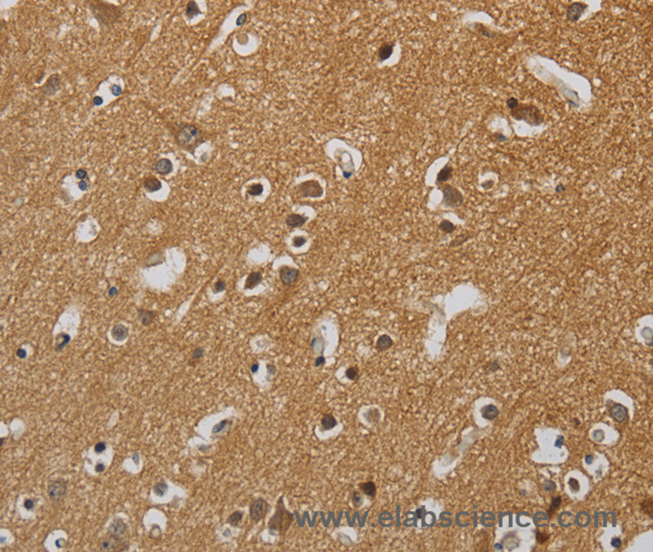 Immunohistochemistry of paraffin-embedded Human brain  tissue using KIF4A Polyclonal Antibody at dilution 1:40