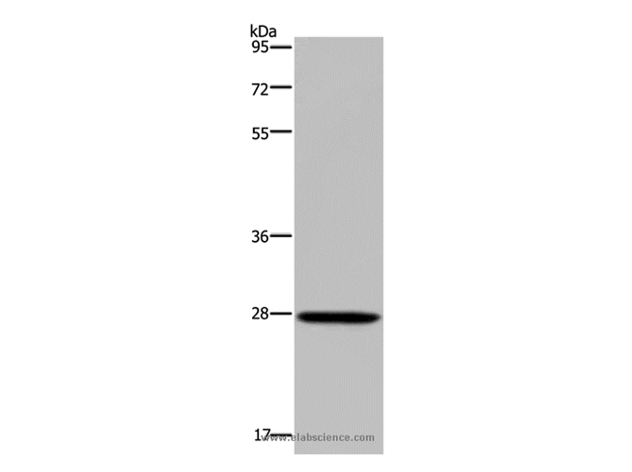 Western Blot analysis of Mouse spleen tissue using KLK14 Polyclonal Antibody at dilution of 1:300